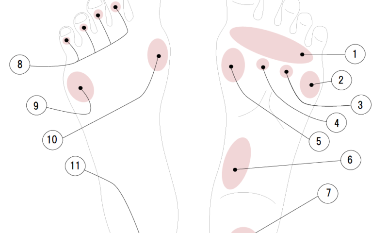 Faceとfootの専門サロン Ylc タコ ウオノメ 靴擦れマップ
